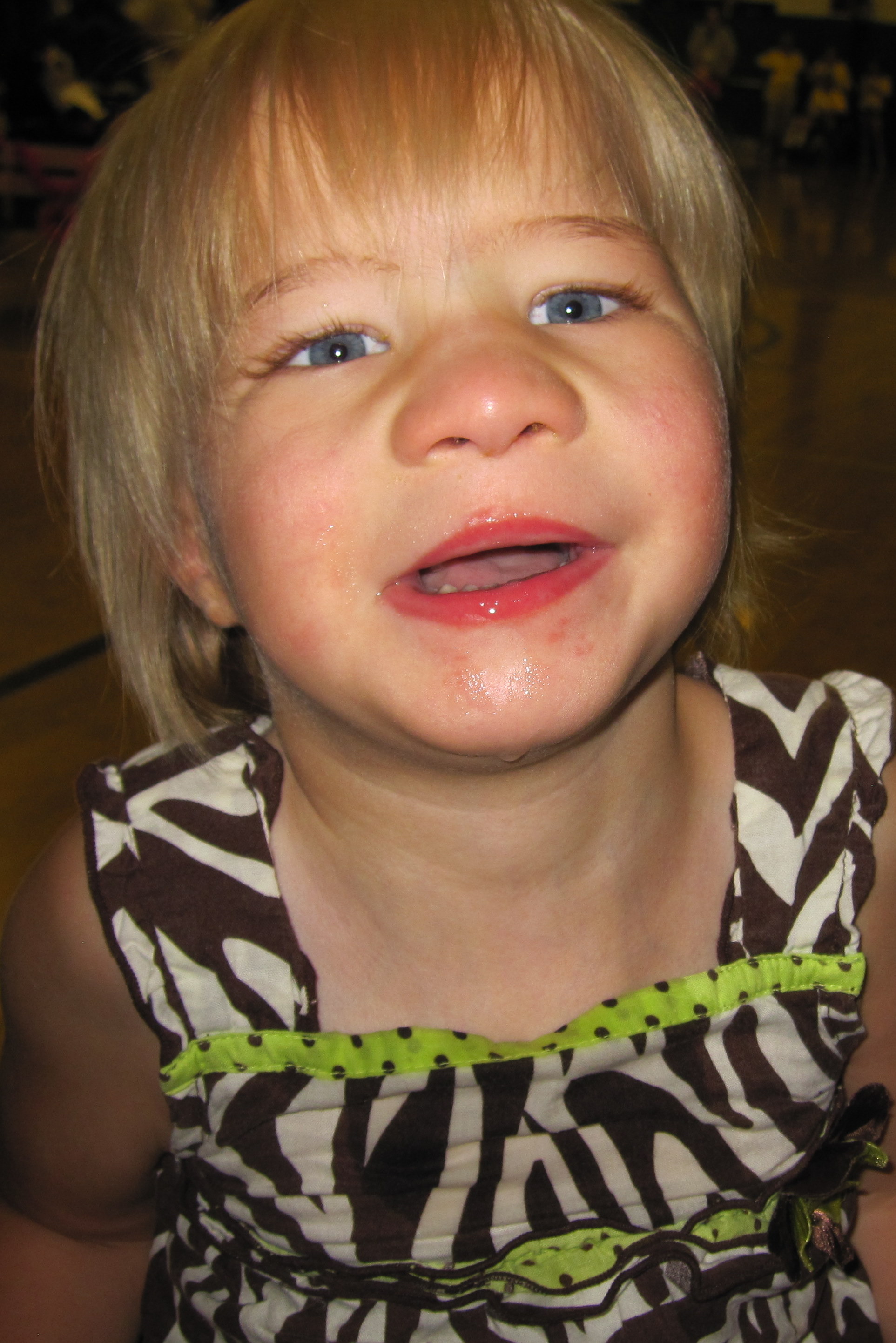 Child-Lillian T13M 4.5 yrs - SOFT - Support Organization For Trisomy