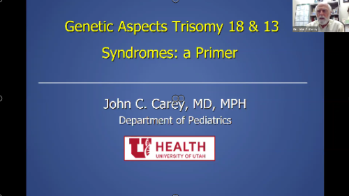 Video – Trisomy 13 and 18: The Basics