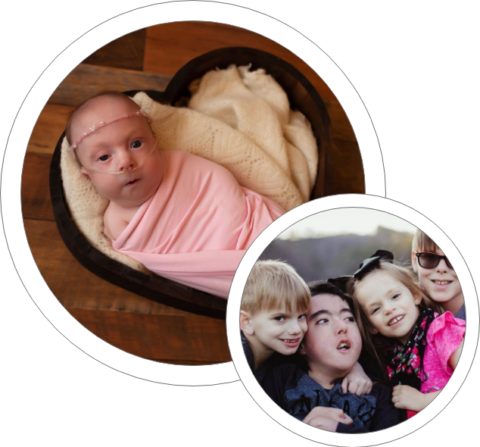 Support Organization for Trisomy | SOFT