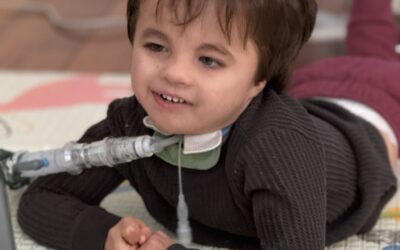 Trisomy Awareness Month Spotlight – Megan Swanson
