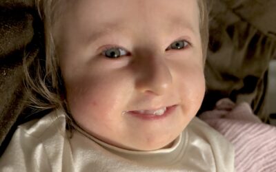Trisomy Awareness Month Spotlight – Cat Leopard