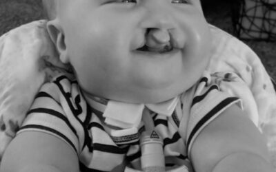 Trisomy Awareness Month Spotlight – Alesha Gibler