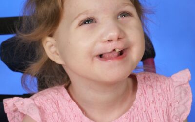 Trisomy Awareness Month Spotlight – Cindy Sampson