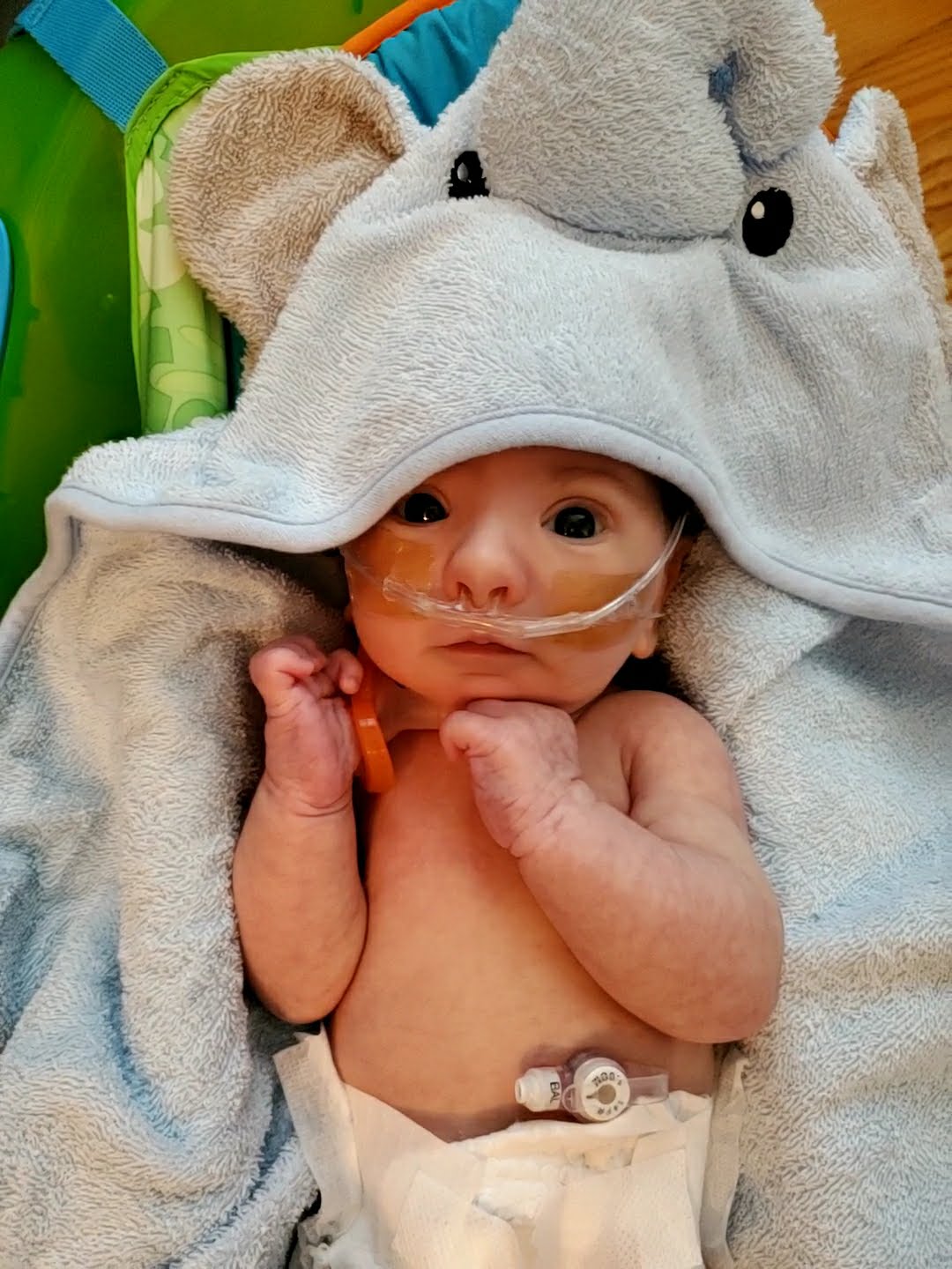 Baby Patrick with Trisomy 9 at Lurie Children's
