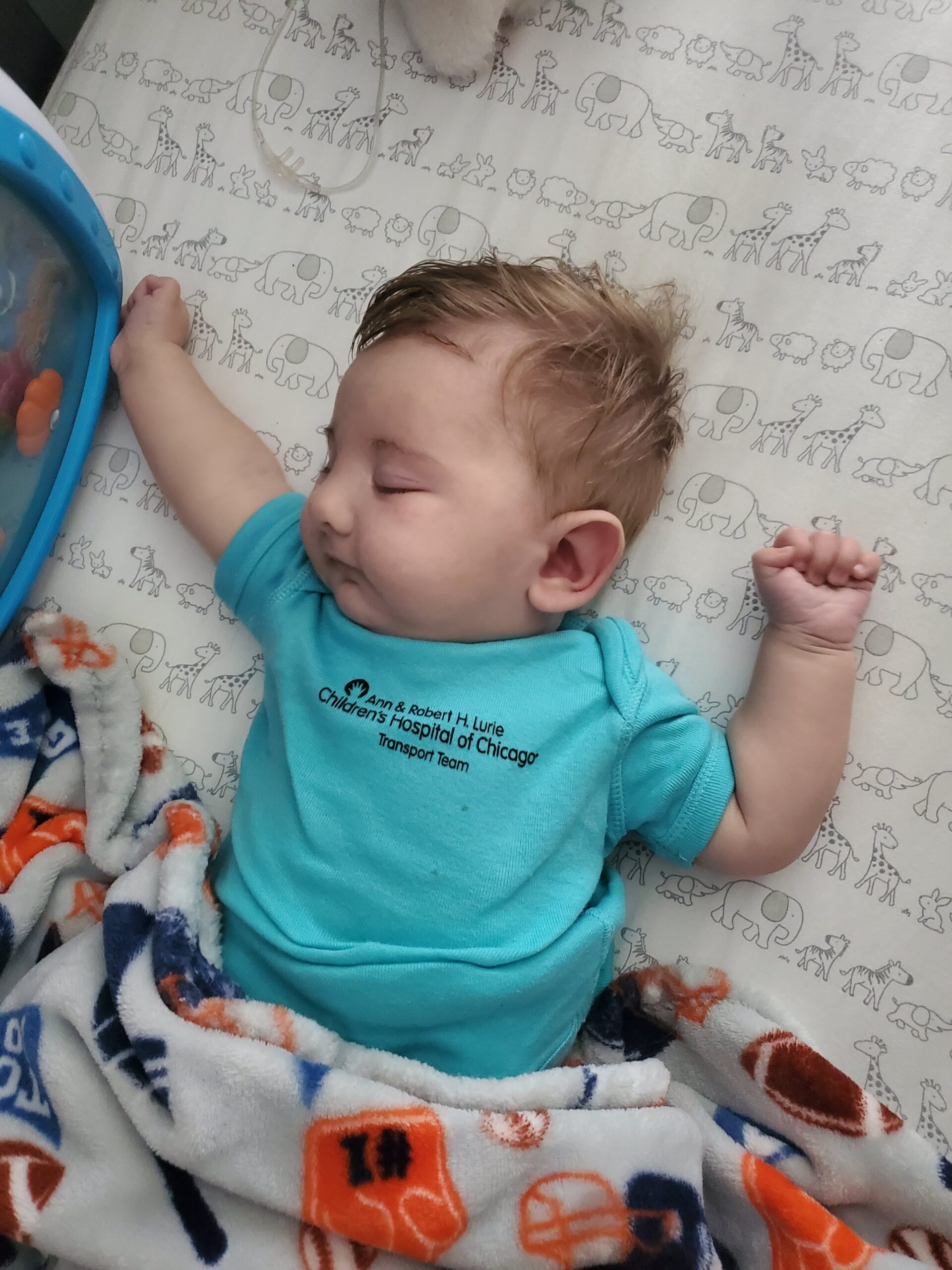 Patrick Jerzyk before hair loss — Trisomy 9 child