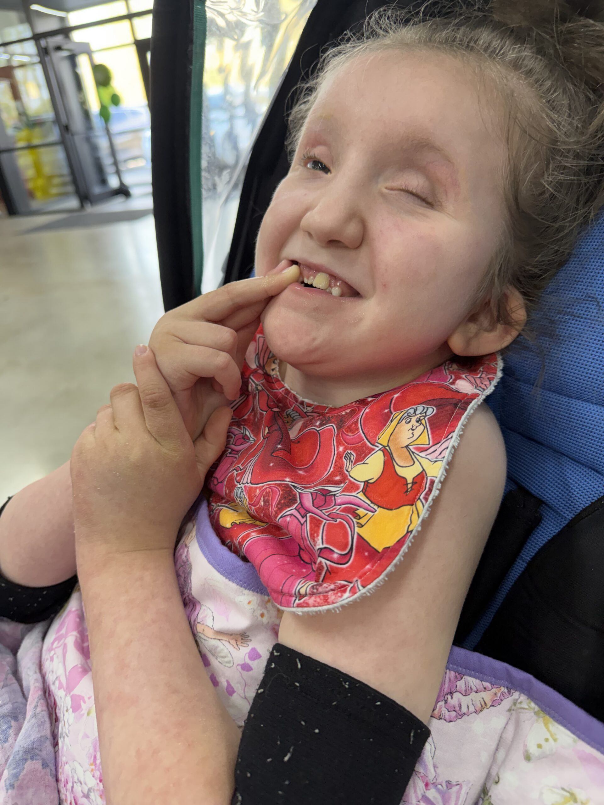 Ivy, a child with Trisomy 9 Mosaic, at home