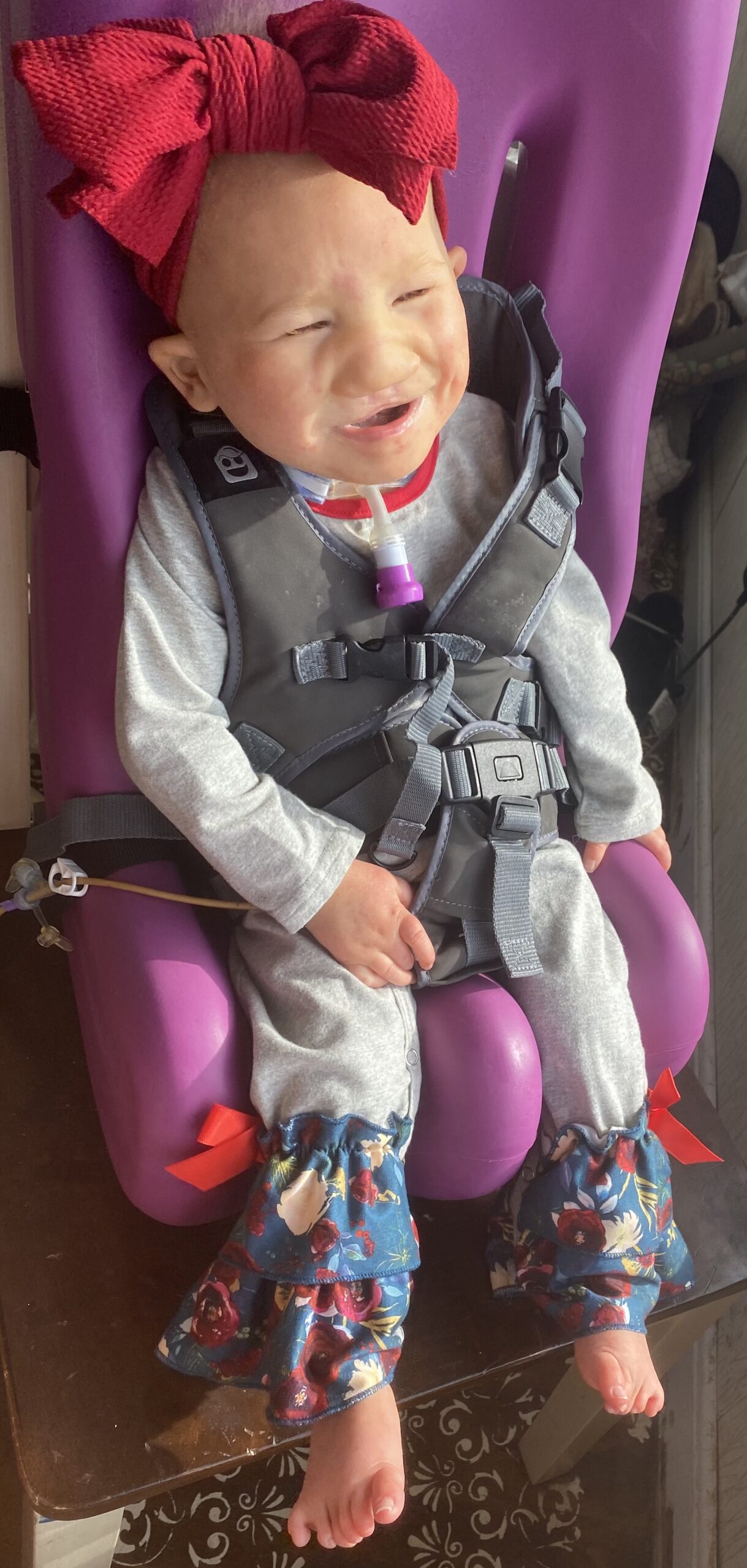 Izzy Farmer, a seven year old girl with Trisomy 13