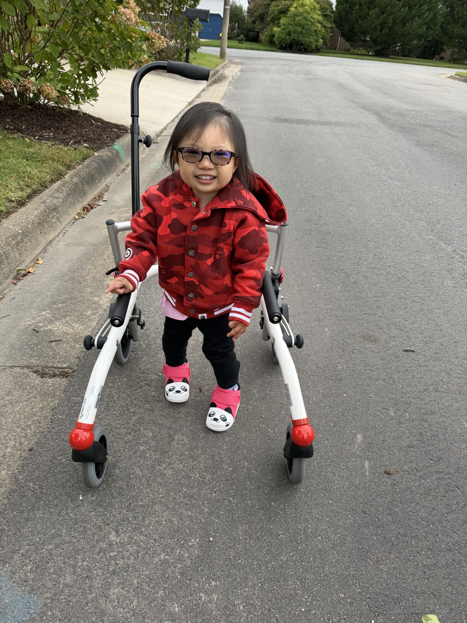 Aliana Sibal, a three year old girl with Trisomy 9q