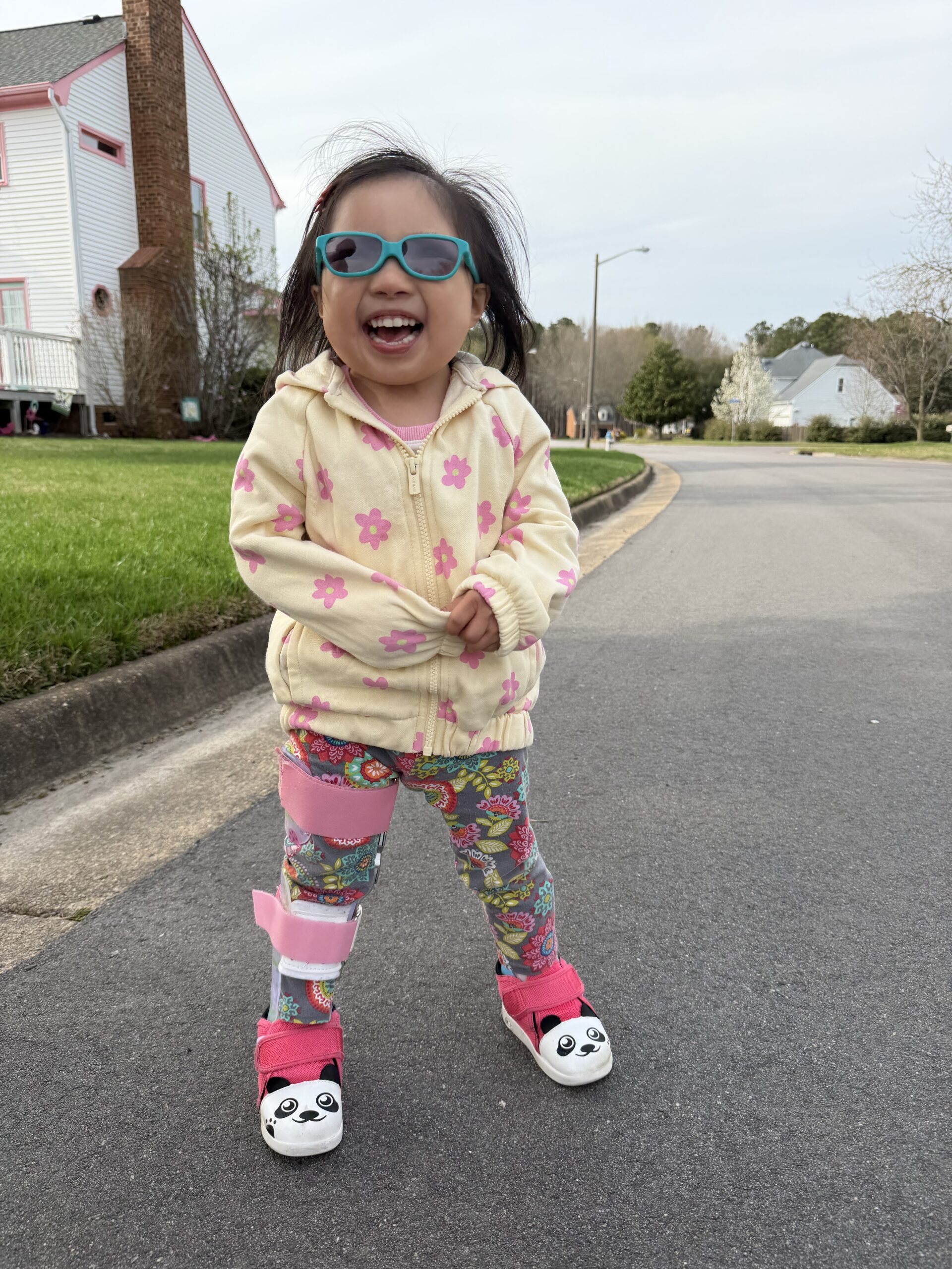 Aliana Sibal, a young girl with partial Trisomy 9q