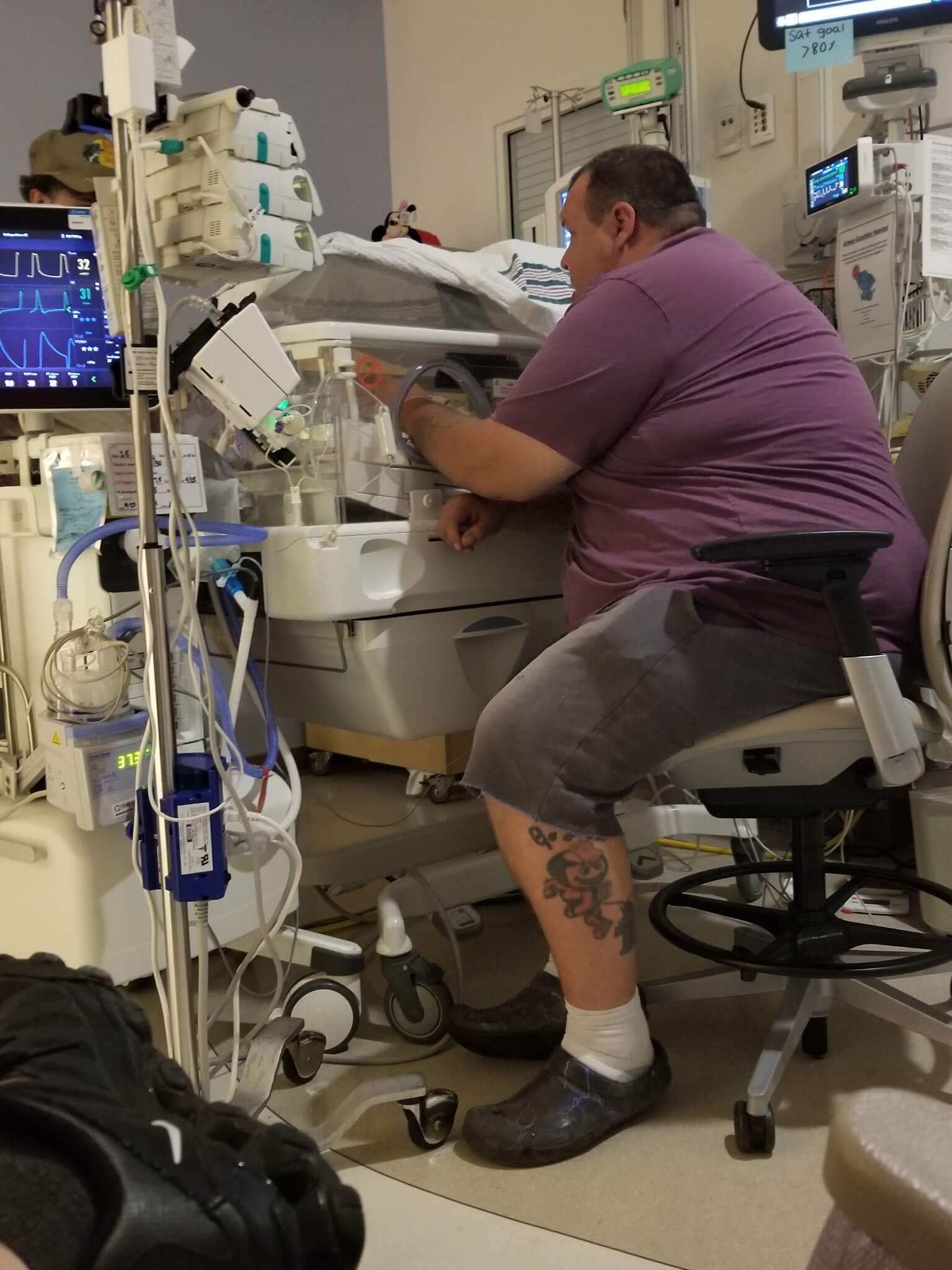 Zoee Wisecarver Trisomy 18 family moment in the NICU